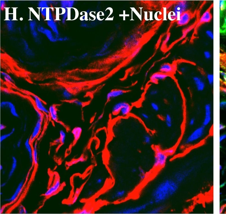 Detection of Mouse CD39L1/ENTPD2 by Immunocytochemistry/Immunofluorescence