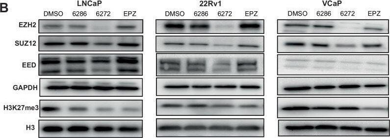 Detection of EED by Western Blot