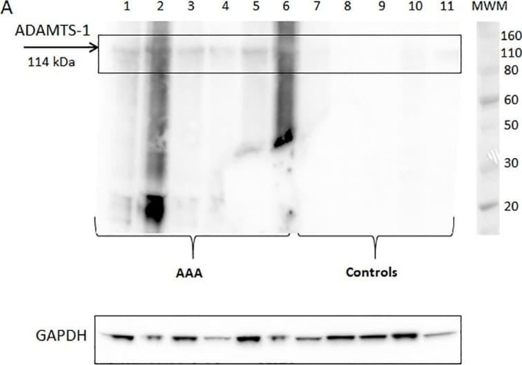 Detection of Human ADAMTS1 by Western Blot
