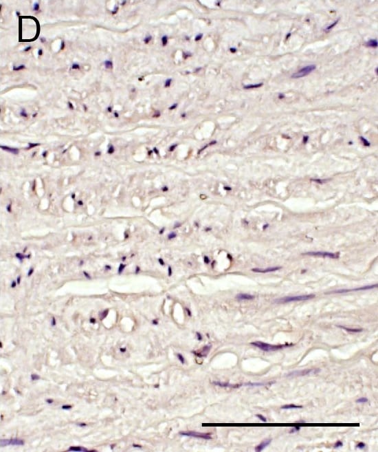 Detection of Human ADAMTS1 by Immunocytochemistry/Immunofluorescence