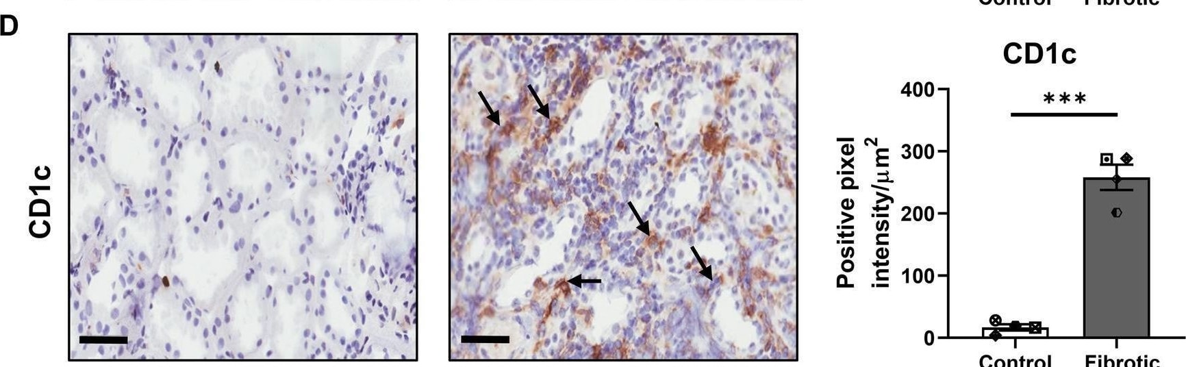Detection of CD1c by Immunohistochemistry