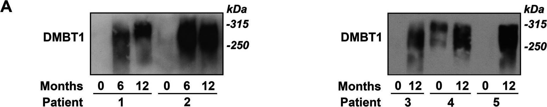 Detection of Mouse DMBT1 by Western Blot