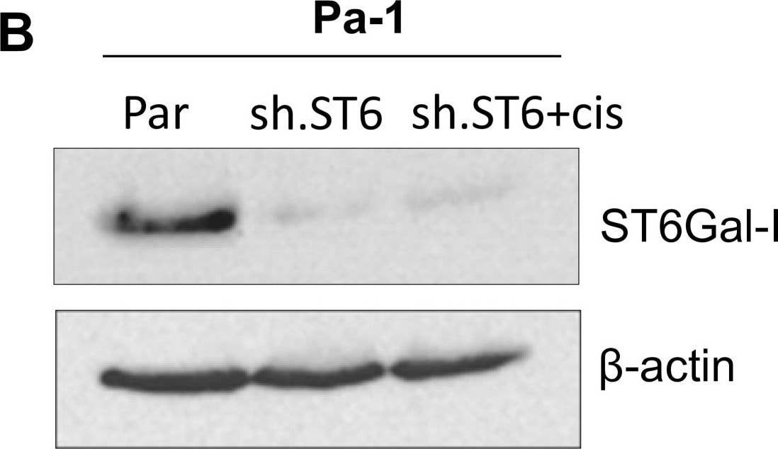 Detection of Human ST6 Gal Sialyltransferase 1/ST6GAL1/CD75 by Western Blot