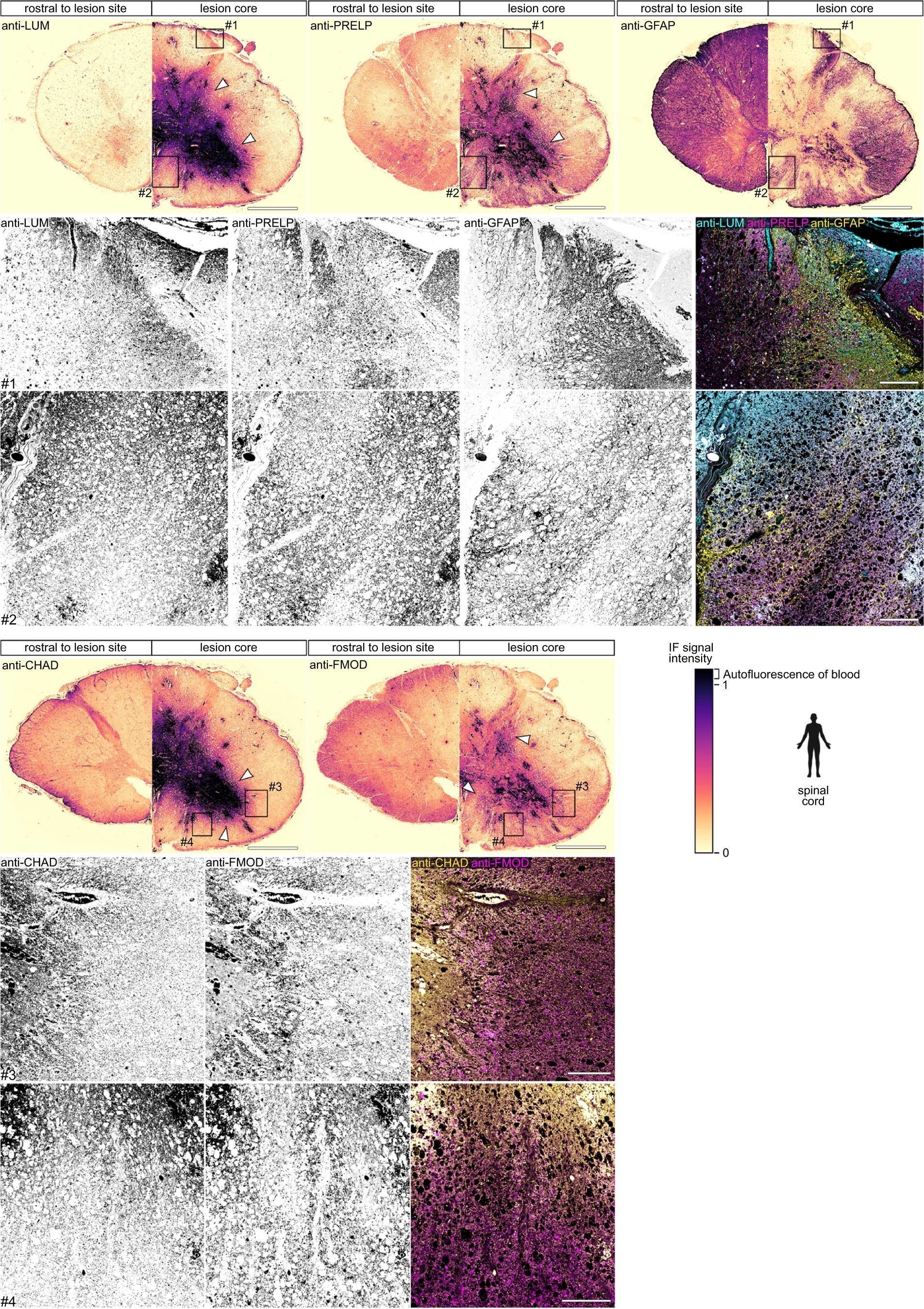 Detection of Zebrafish Fibromodulin/FMOD by Immunohistochemistry