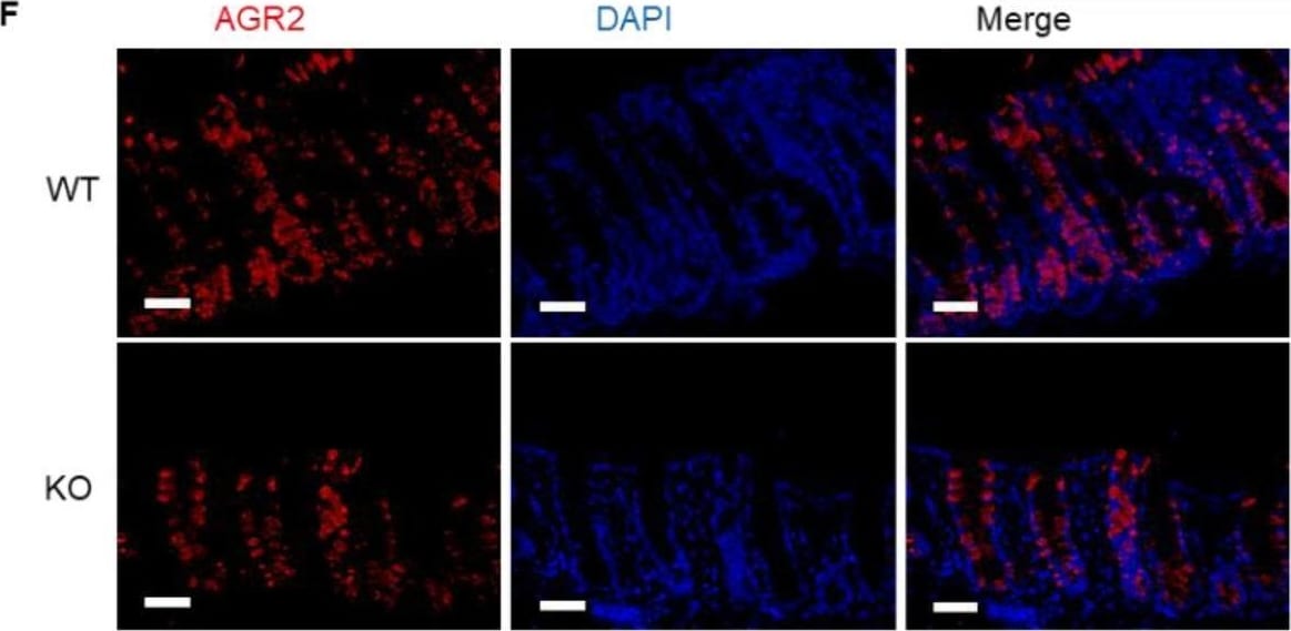 Detection of AG-2/AGR2 by Immunohistochemistry