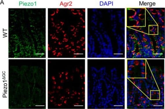 Detection of AG-2/AGR2 by Immunohistochemistry