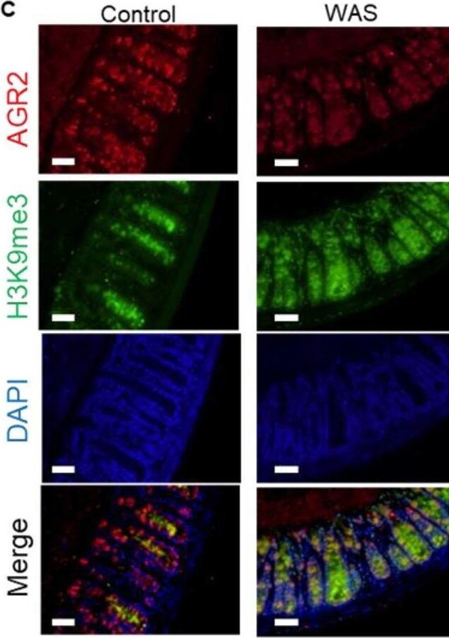 Detection of AG-2/AGR2 by Immunohistochemistry