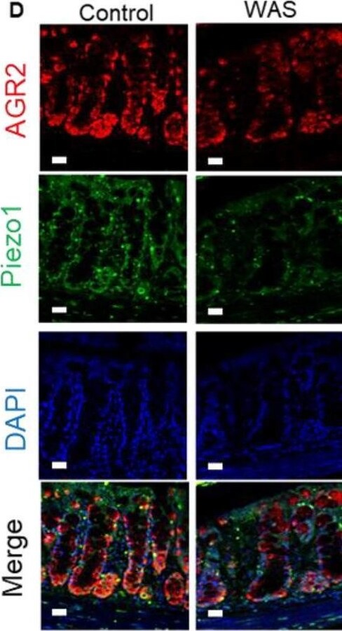 Detection of AG-2/AGR2 by Immunohistochemistry