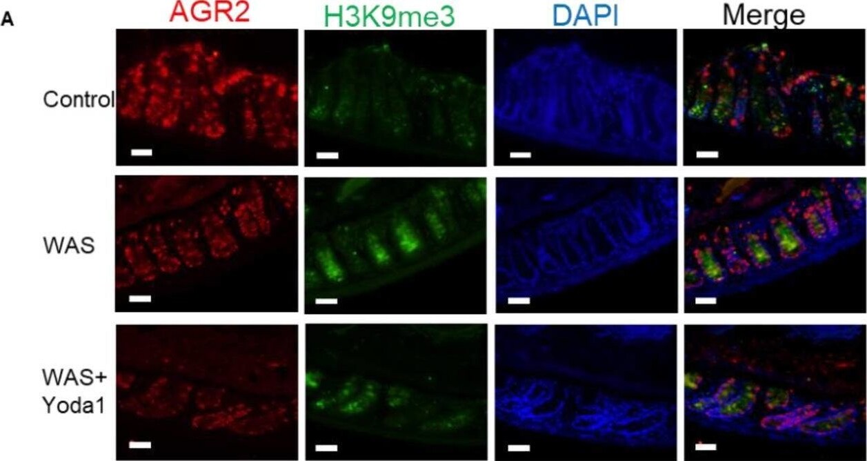 Detection of AG-2/AGR2 by Immunohistochemistry