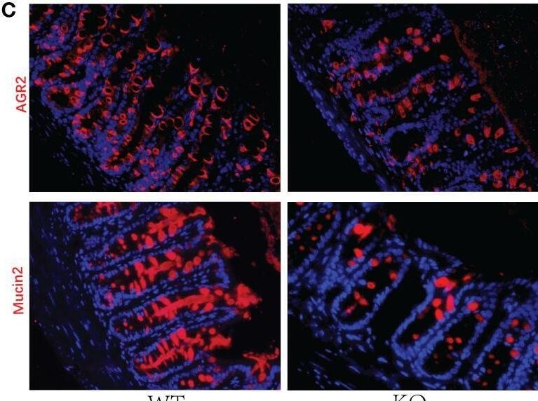 Detection of AG-2/AGR2 by Immunohistochemistry