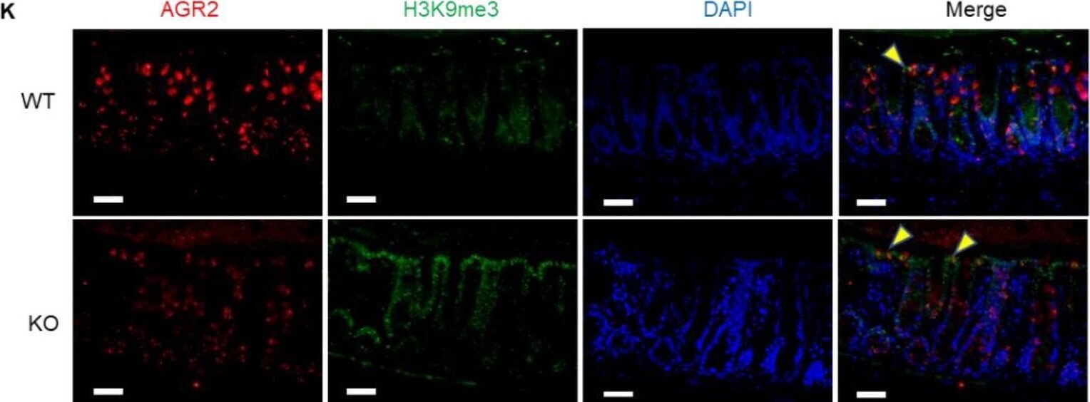 Detection of AG-2/AGR2 by Immunohistochemistry