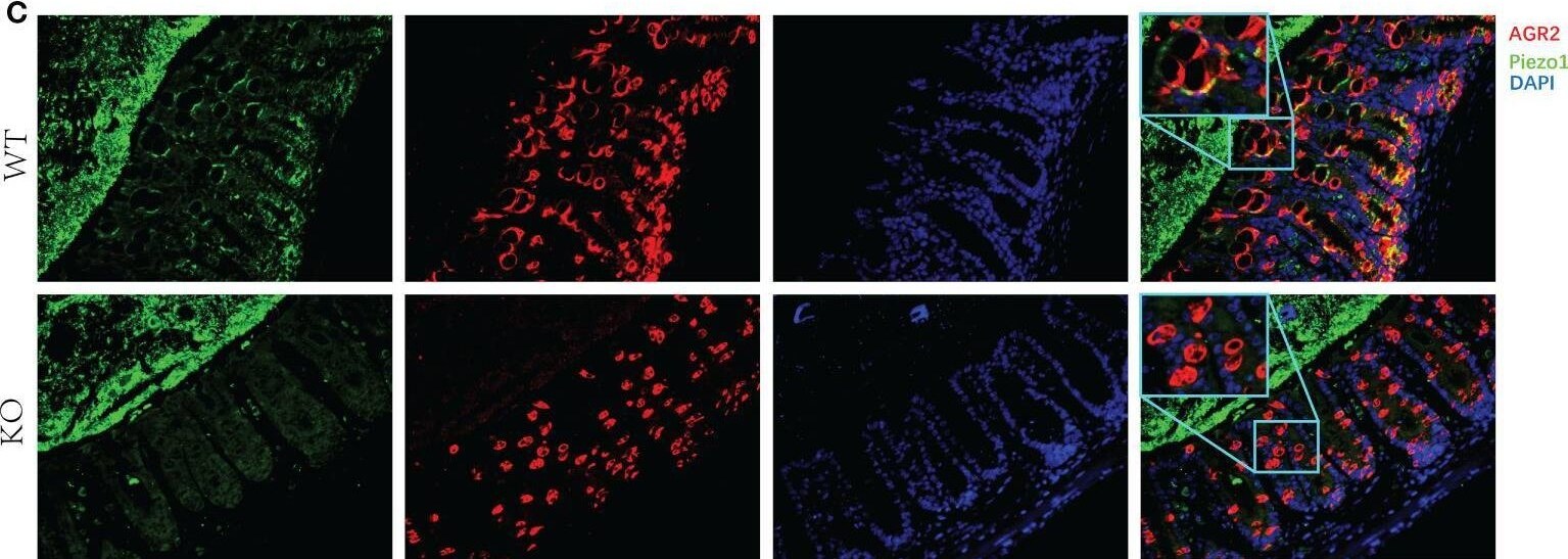 Detection of AG-2/AGR2 by Immunohistochemistry