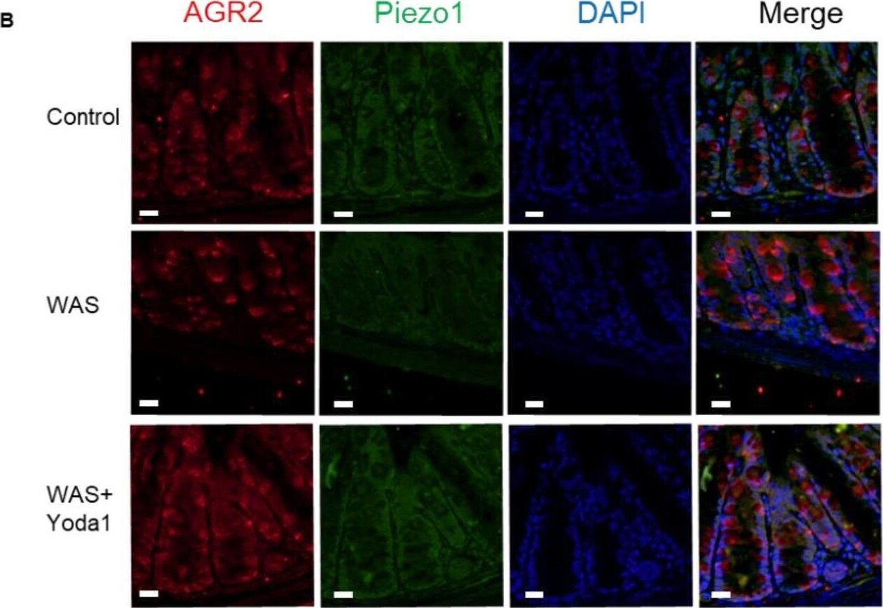 Detection of AG-2/AGR2 by Immunohistochemistry