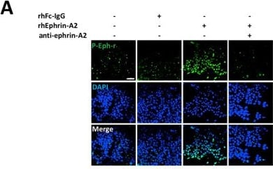 Detection of EphA6 by Immunocytochemistry/ Immunofluorescence