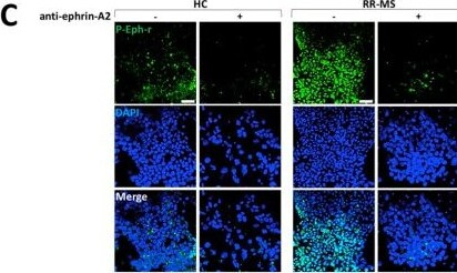 Detection of EphA6 by Immunocytochemistry/ Immunofluorescence