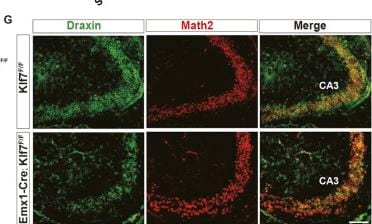 Detection of Draxin by Immunohistochemistry