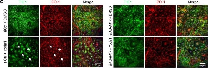 Detection of Tie-1 by Immunohistochemistry