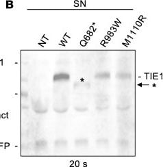 Detection of Tie-1 by Western Blot