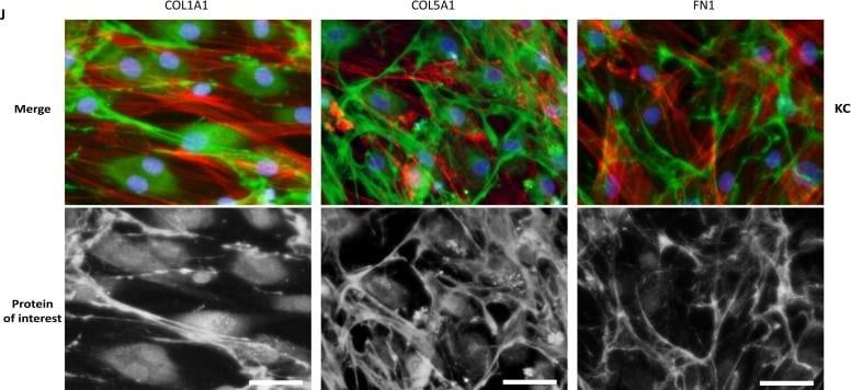 Detection of Pro-Collagen I alpha 1 by Immunocytochemistry/ Immunofluorescence