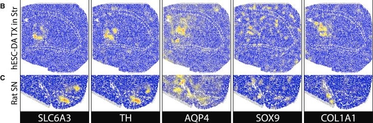 Detection of Pro-Collagen I alpha 1 by Immunohistochemistry