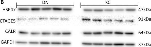 Detection of Pro-Collagen I alpha 1 by Western Blot