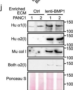 Detection of Pro-Collagen I alpha 1 by Western Blot