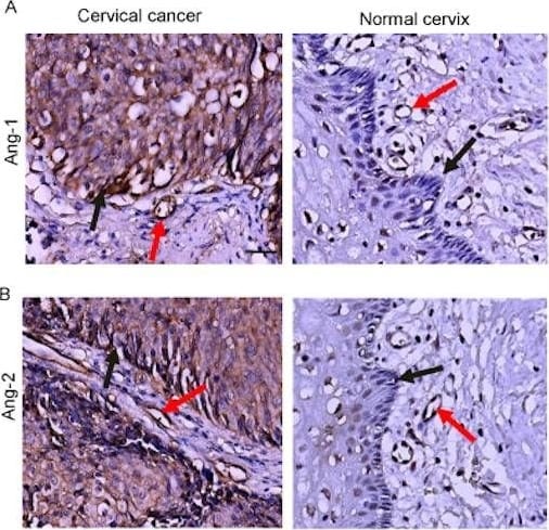 Detection of Human Angiopoietin-2 by Immunohistochemistry