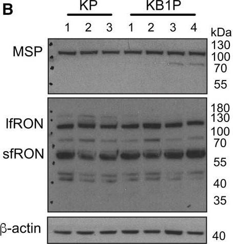 Detection of Mouse MSP/MST1 by Western Blot