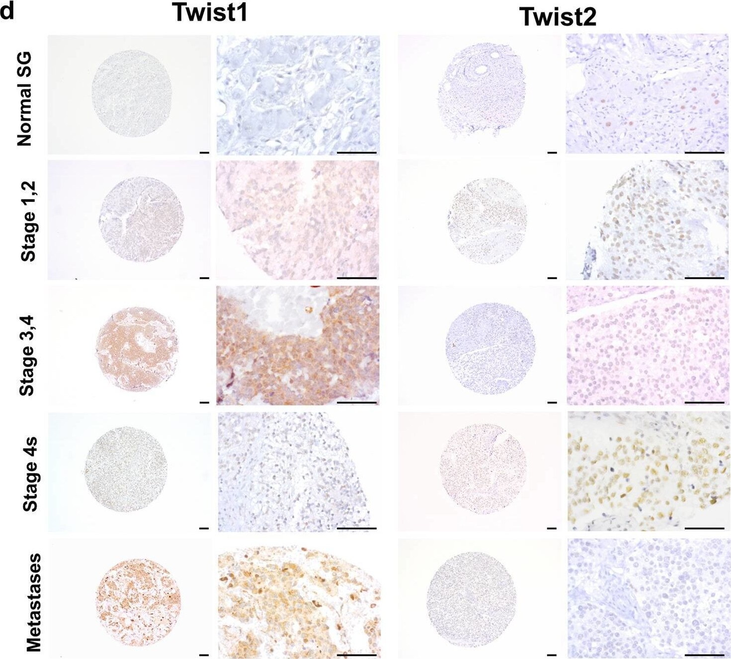 Detection of Twist-2 by Immunohistochemistry