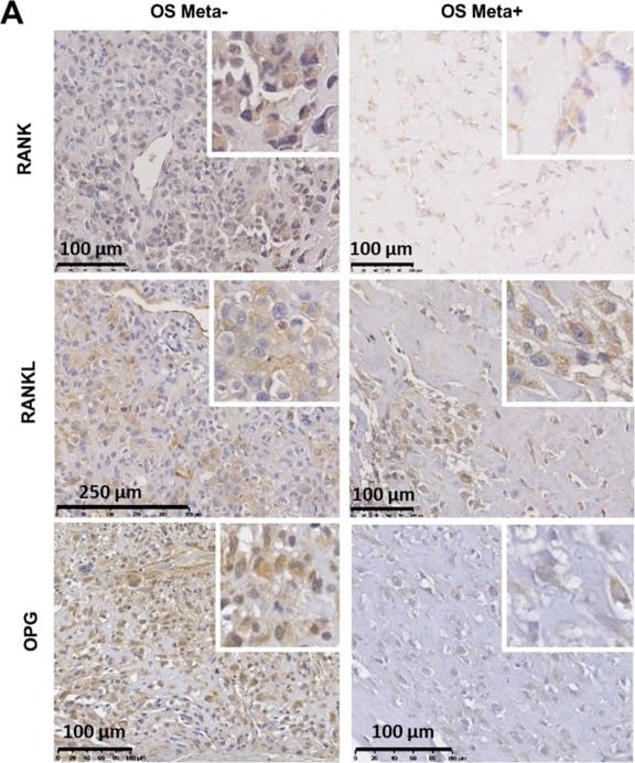 Detection of TRANCE/RANK L/TNFSF11 by Immunohistochemistry