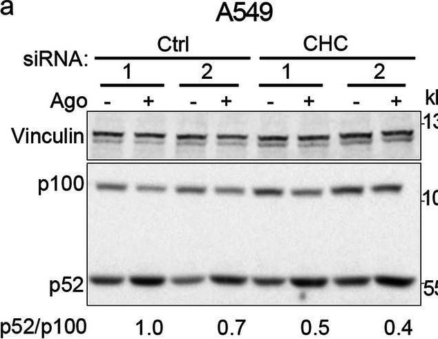 Detection of Lymphotoxin  beta R/TNFRSF3 by Western Blot