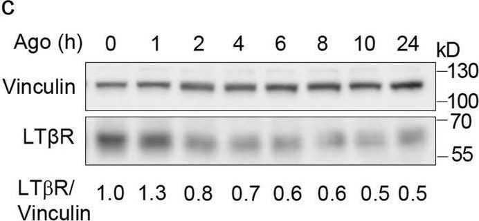 Detection of Lymphotoxin  beta R/TNFRSF3 by Western Blot