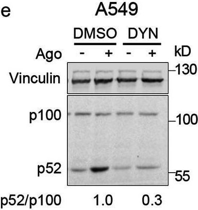 Detection of Lymphotoxin  beta R/TNFRSF3 by Western Blot