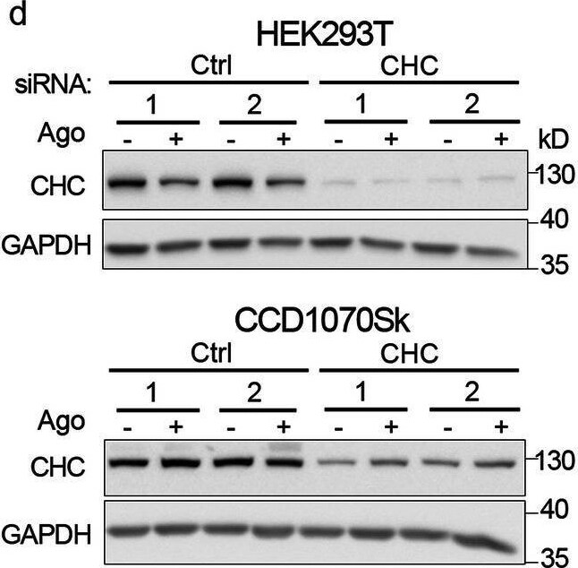 Detection of Lymphotoxin  beta R/TNFRSF3 by Western Blot
