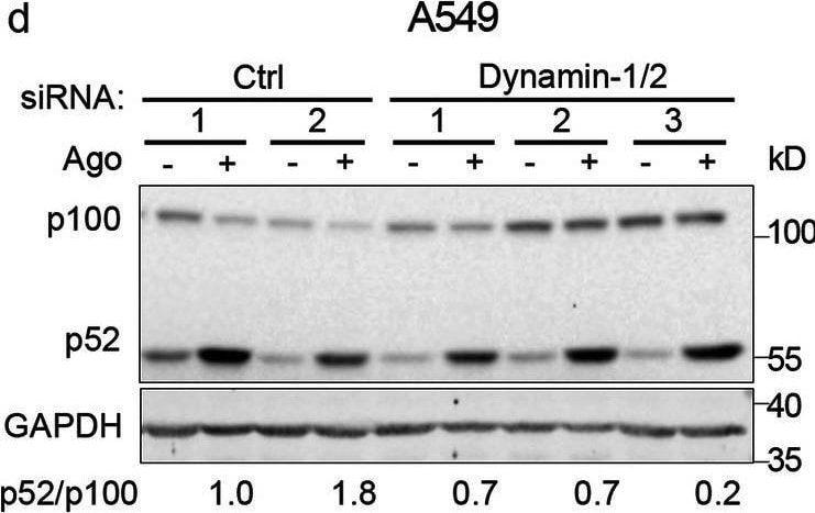 Detection of Lymphotoxin  beta R/TNFRSF3 by Western Blot