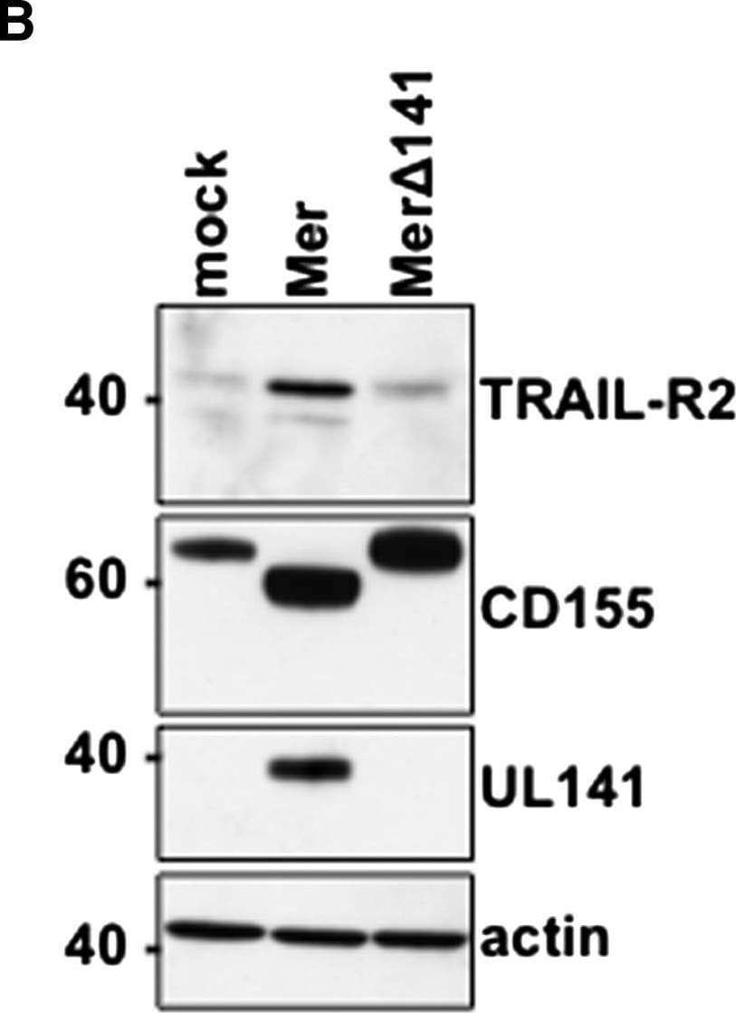 Detection of Human TRAIL R2/TNFRSF10B by Western Blot