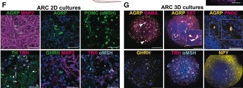 Detection of AgRP by Immunohistochemistry