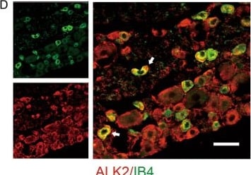 Detection of Activin RIA by Immunohistochemistry
