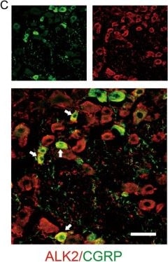 Detection of Activin RIA by Immunohistochemistry