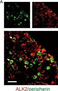 Detection of Activin RIA by Immunohistochemistry