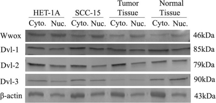 Detection of Human WWOX by Western Blot