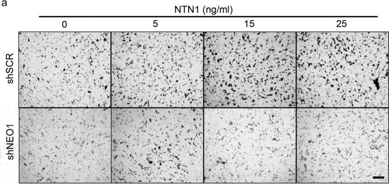 Detection of Netrin-1 by Immunohistochemistry
