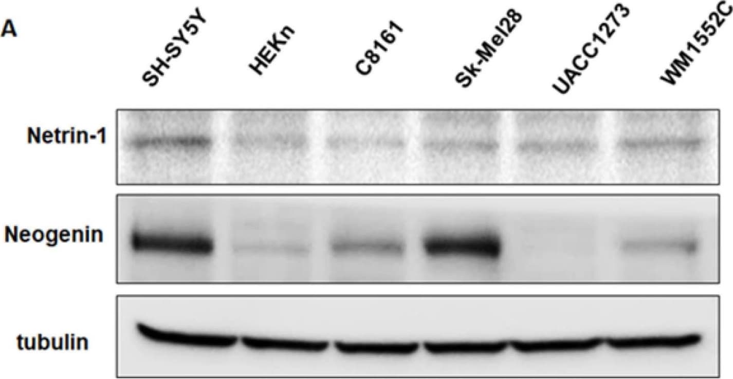 Detection of Netrin-1 by Western Blot