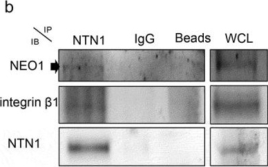 Detection of Netrin-1 by Western Blot