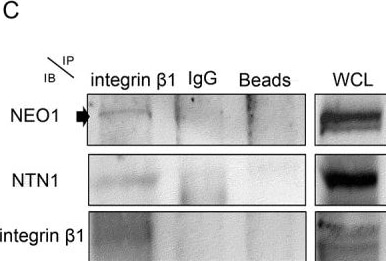 Detection of Netrin-1 by Western Blot