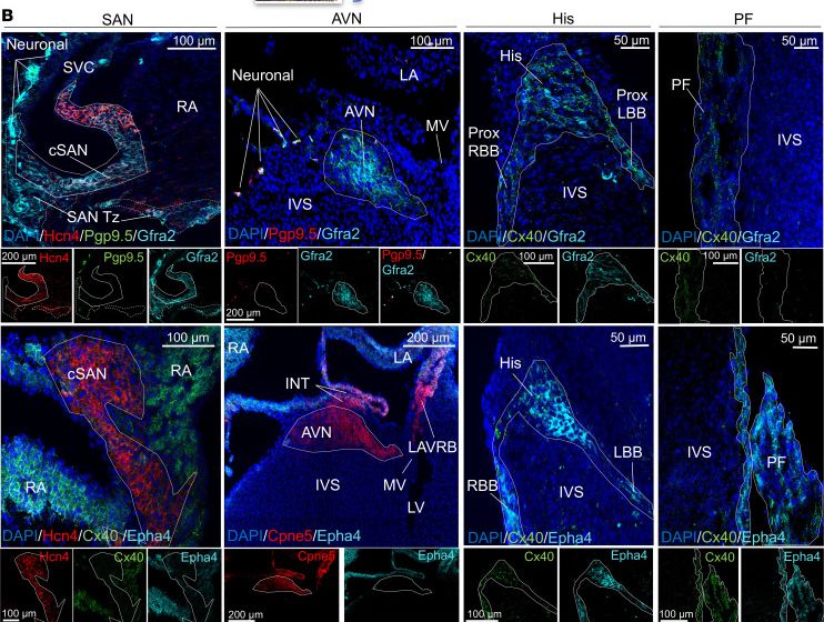 Detection of EphA4 by Immunohistochemistry