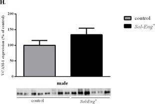Detection of Mouse VCAM-1/CD106 by Western Blot