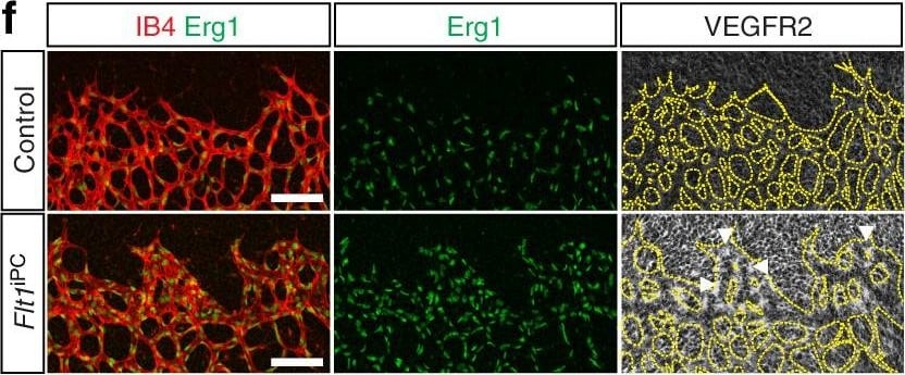 Detection of Mouse VEGFR2/KDR/Flk-1 by Immunocytochemistry/Immunofluorescence