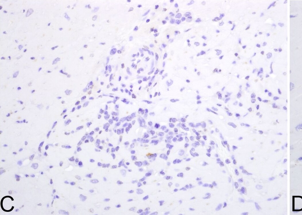 Detection of Rhesus Macaque IL-18/IL-1F4 by Immunohistochemistry