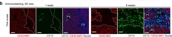 Detection of CEACAM-1/CD66a by Immunohistochemistry